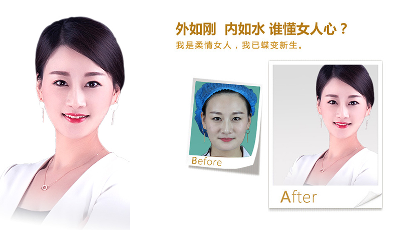 唐山V脸、线雕隆鼻